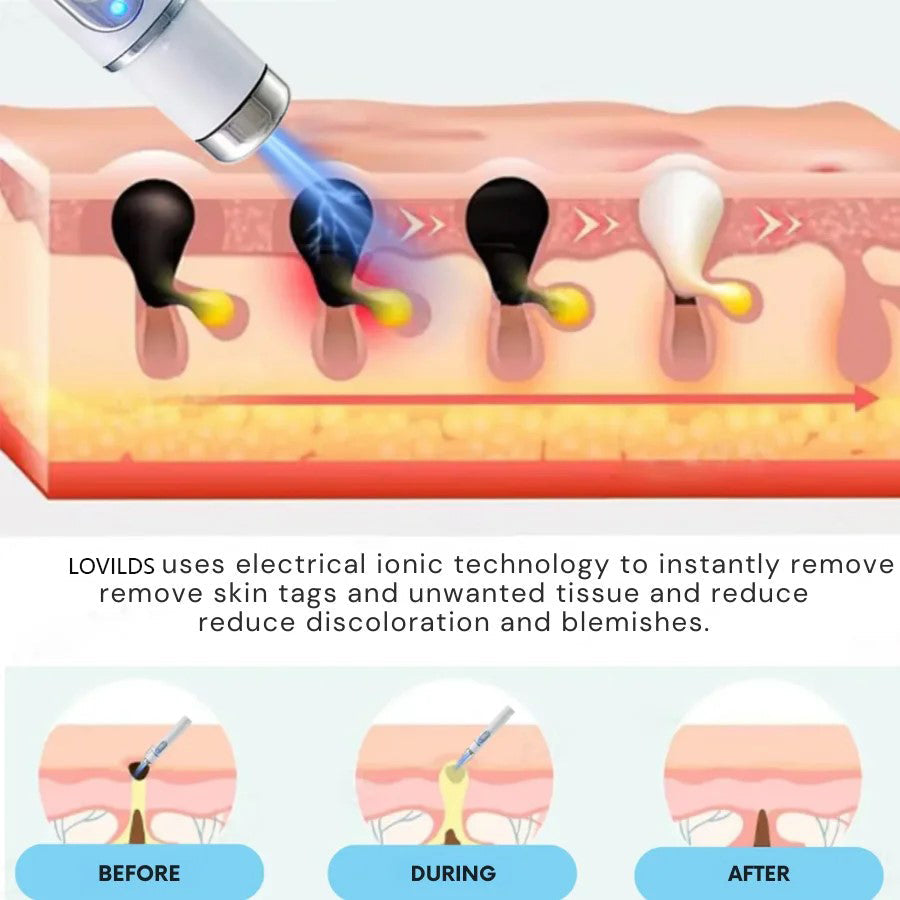Bloomelle ClearSkin™ Precision Skin Pen