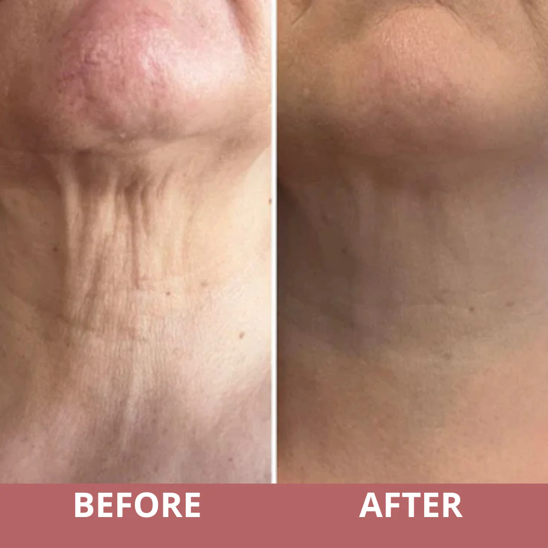 Tighten & Life Neck Cream by PinkSugar