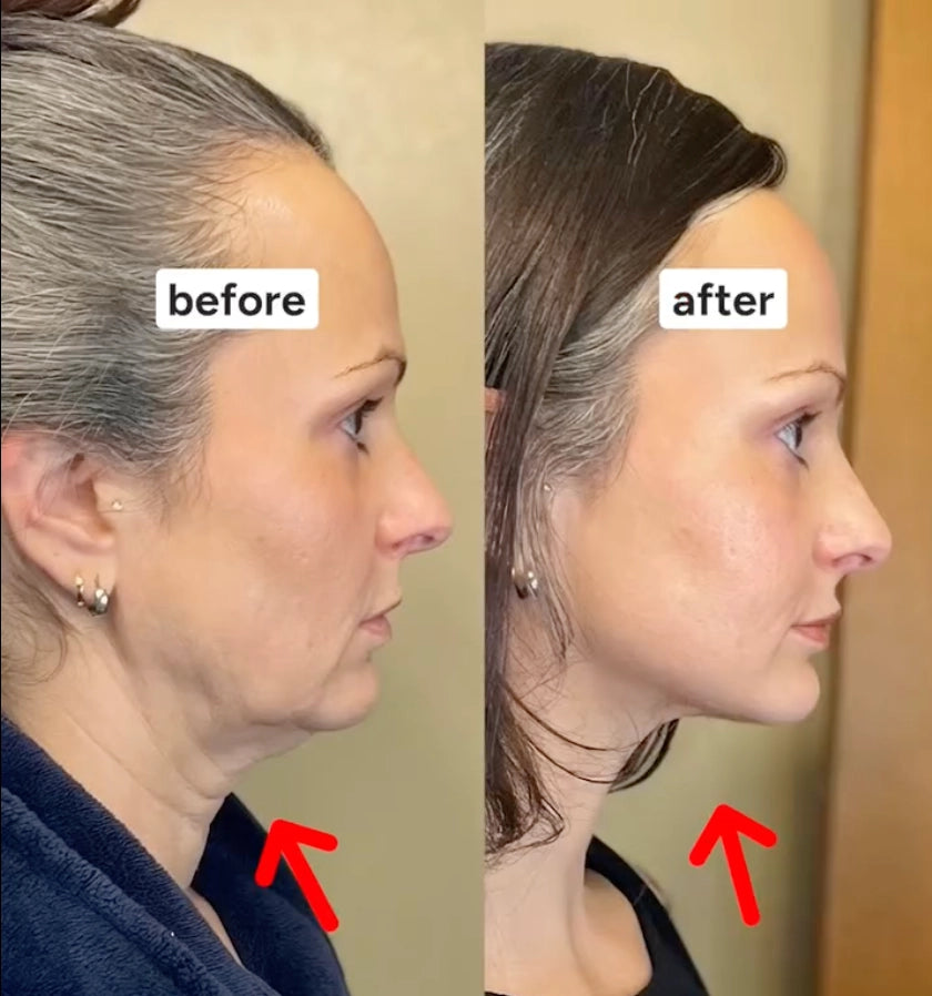 Collagen Face Sculpt Wrap (BUY 1 GET 1 FREE)