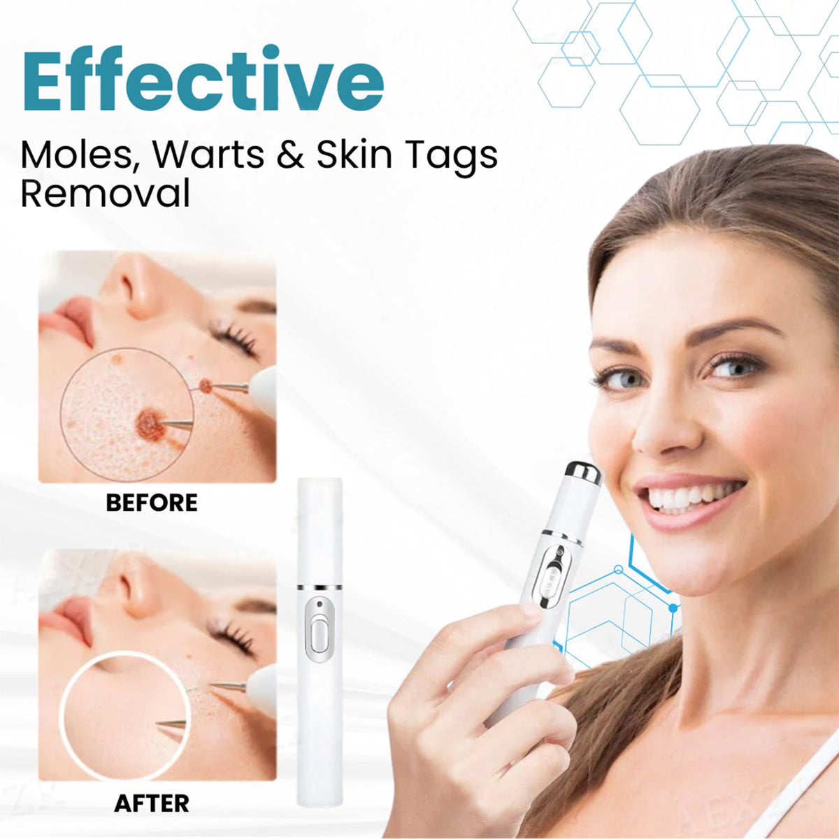 Bloomelle ClearSkin™ Precision Skin Pen