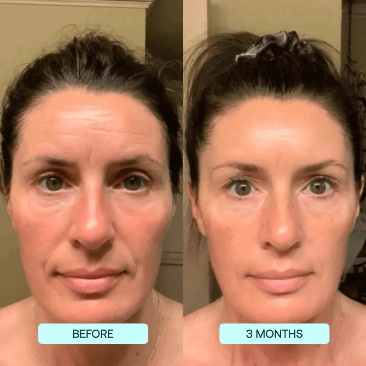 NANO SKIN™  FACE REJUVENATION ANTI AGING FORMULA COLLAGEN FILMS