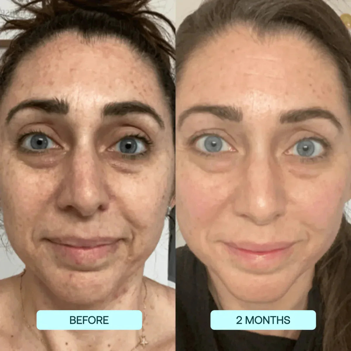 NANO SKIN™  FACE REJUVENATION ANTI AGING FORMULA COLLAGEN FILMS