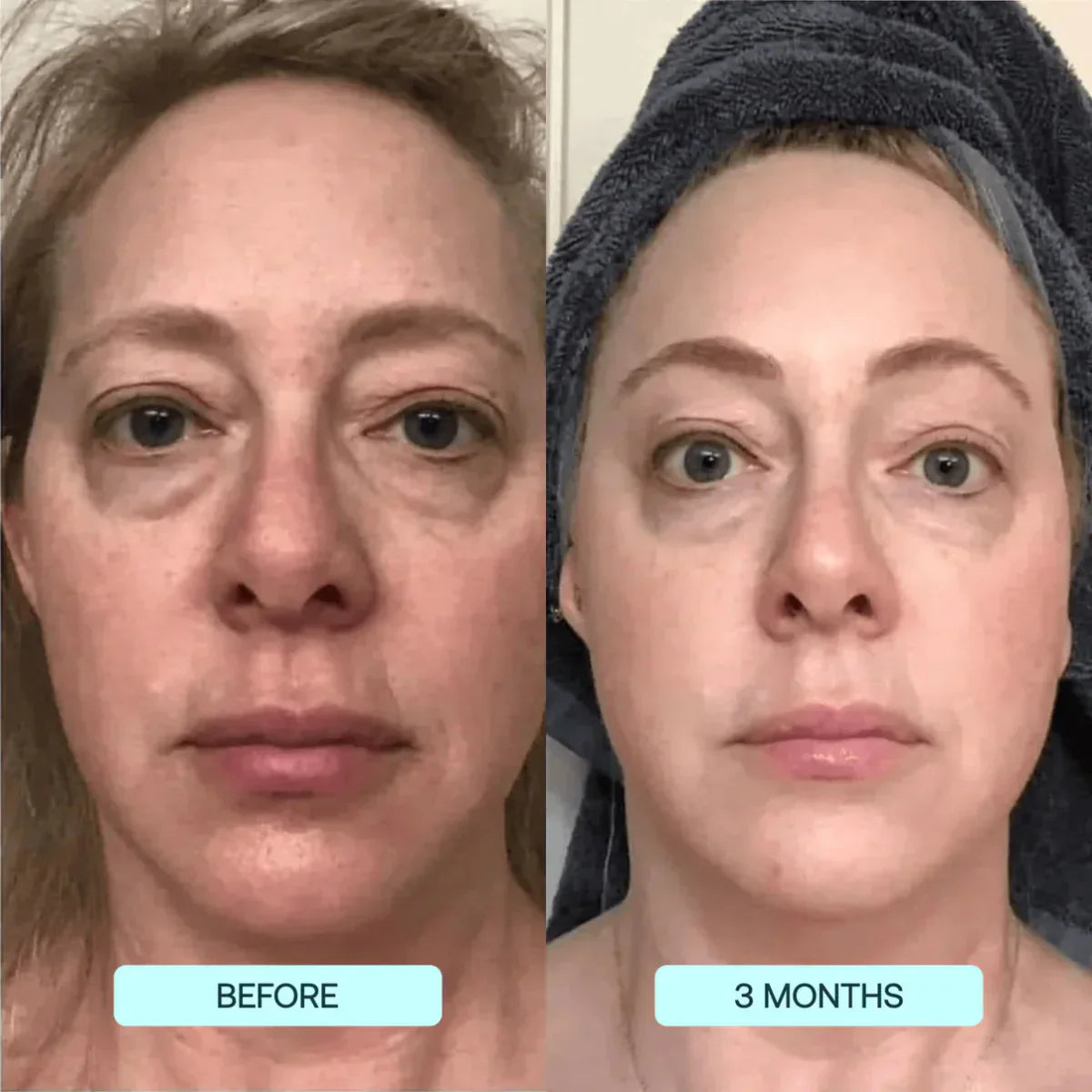NANO SKIN™  FACE REJUVENATION ANTI AGING FORMULA COLLAGEN FILMS