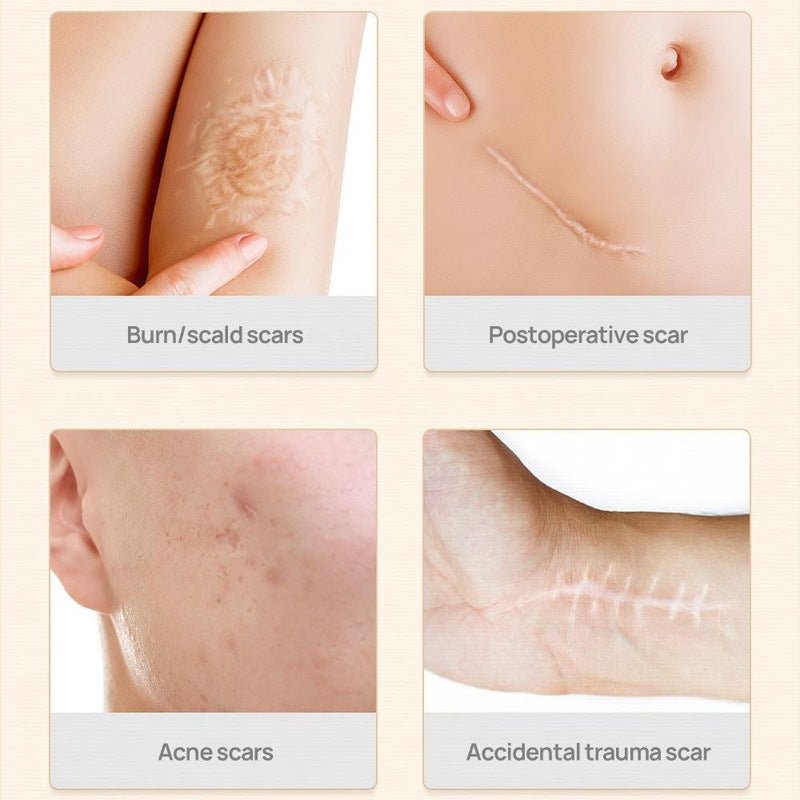 Vitamin E Scar & Stretch Mark serum 50ml
